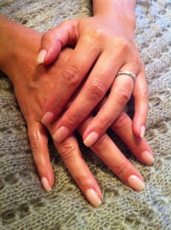 Ann - Bild 2 Efter