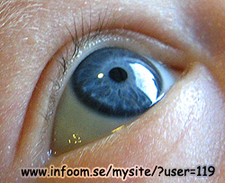 Name: eye_closeup.jpg  Width: 250px  Height: 203px