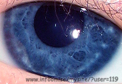 Name: eye.jpg  Width: 250px  Height: 172px