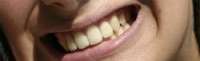 smil